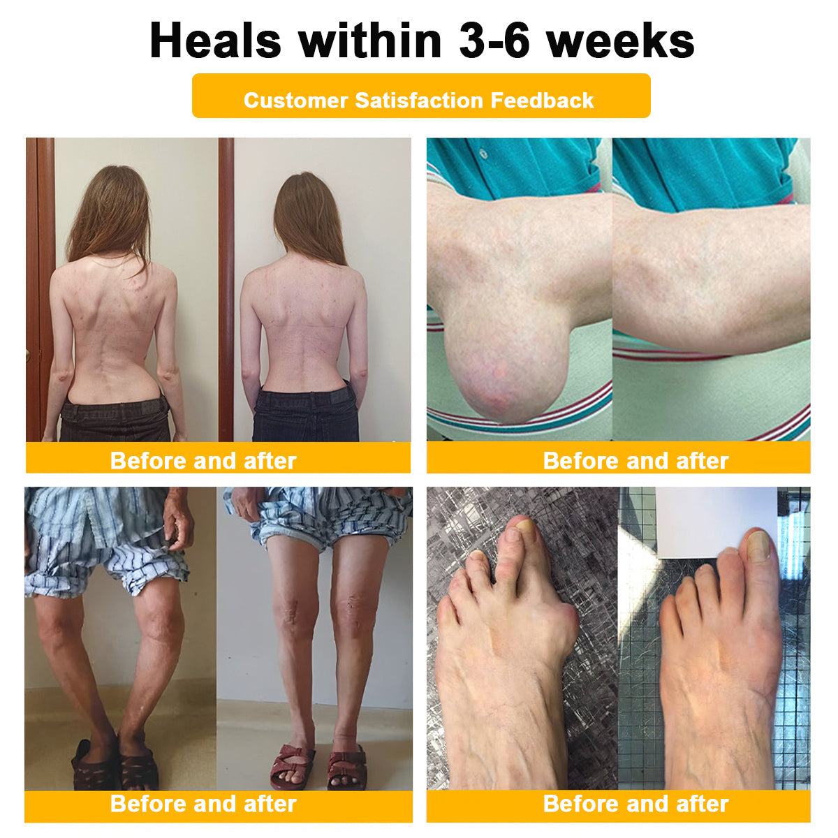šAQA⢠Botulinum & Bee Essence Pain-Relief Bone Healing Creamļ¼åÆę¬ļ¼