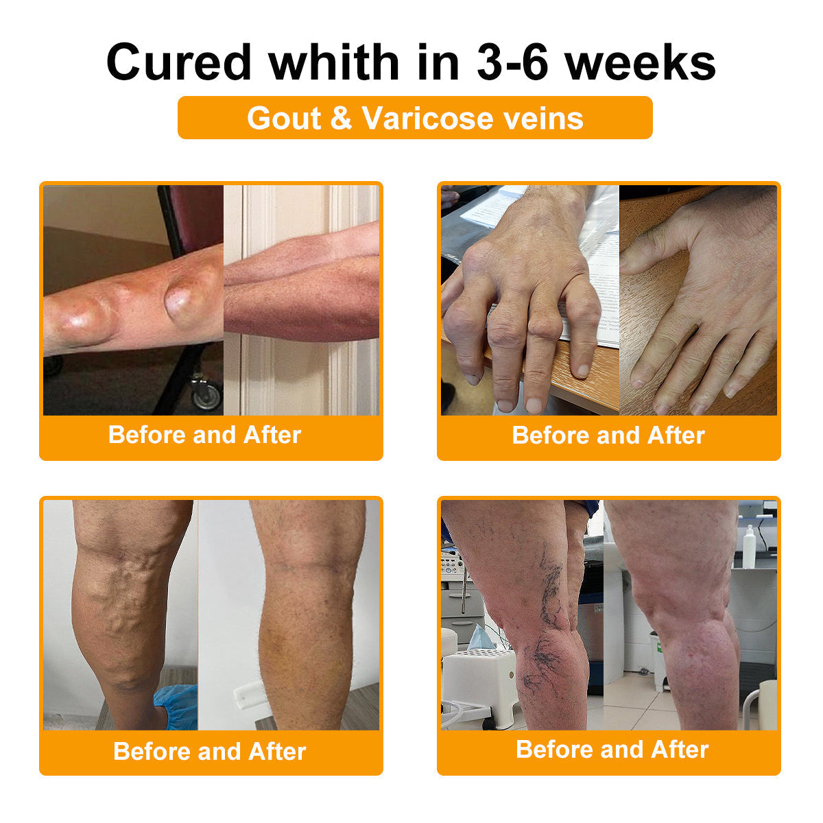 šAQA⢠Botulinum & Bee Essence Pain-Relief Bone Healing Creamļ¼åÆę¬ļ¼
