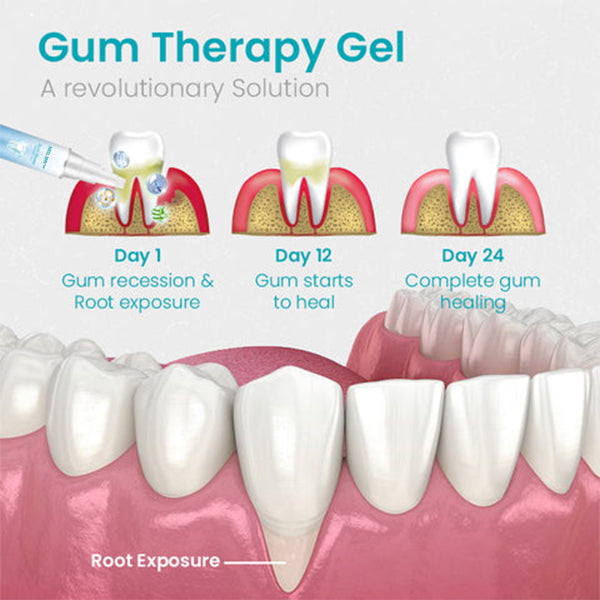 š„Last Day Promotion 80% OFF-LOVILDS⢠Gum Shield Therapy Gel