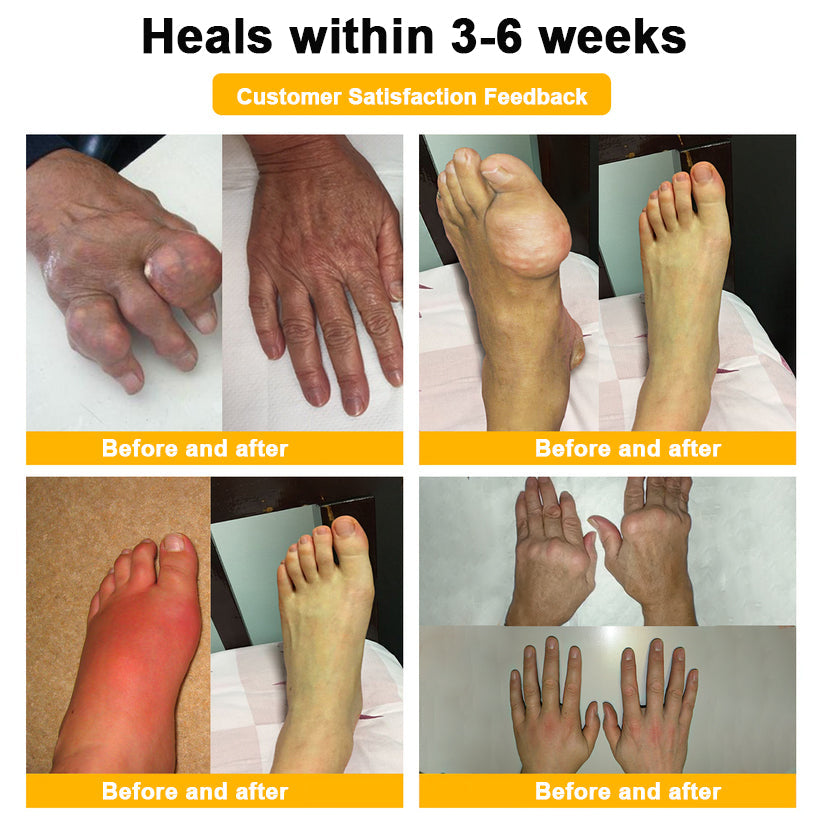 šAQA⢠Botulinum & Bee Essence Pain-Relief Bone Healing Creamļ¼åÆę¬ļ¼