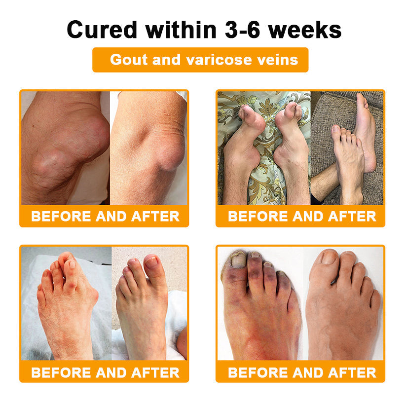 šAQA⢠Botulinum & Bee Essence Pain-Relief Bone Healing Creamļ¼åÆę¬ļ¼