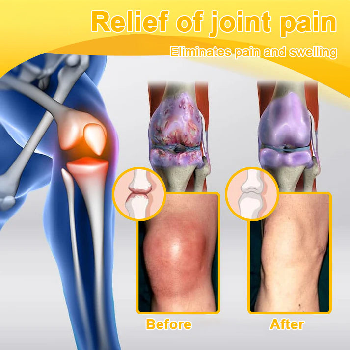 šAQA⢠Botulinum & Bee Essence Pain-Relief Bone Healing Creamļ¼åÆę¬ļ¼