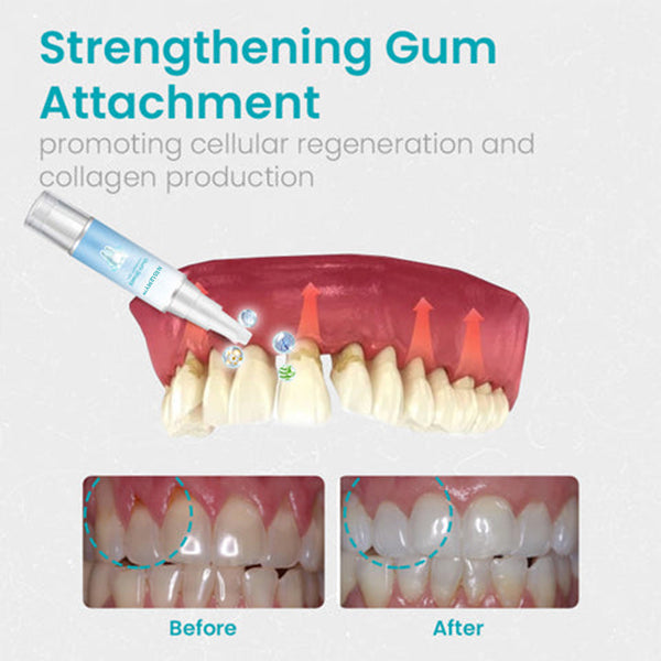 🔥Last Day Promotion 80% OFF-LOVILDS™ Gum Shield Therapy Gel