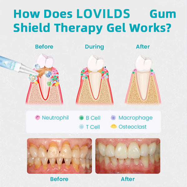 🔥Last Day Promotion 80% OFF-LOVILDS™ Gum Shield Therapy Gel