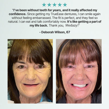 ? Ends Today: 70% OFF! Medazy? Custom-Fit Full Functional DenturesMake you more confident